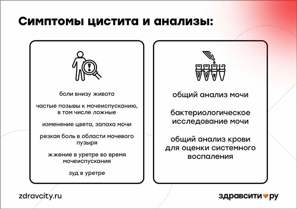 Болезненное мочеиспускание у женщин: причины дискомфорта и эффективное лечение