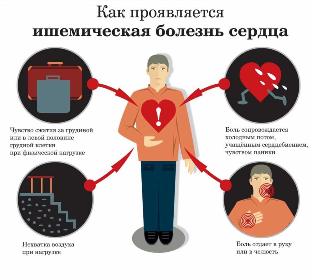 Ишемическая болезнь сердца: ключевые симптомы и признаки