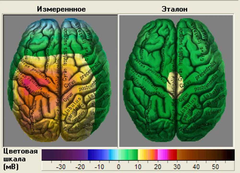 Как проверить работу лишь одной стороны мозга: Полезные методы и тесты для диагностики