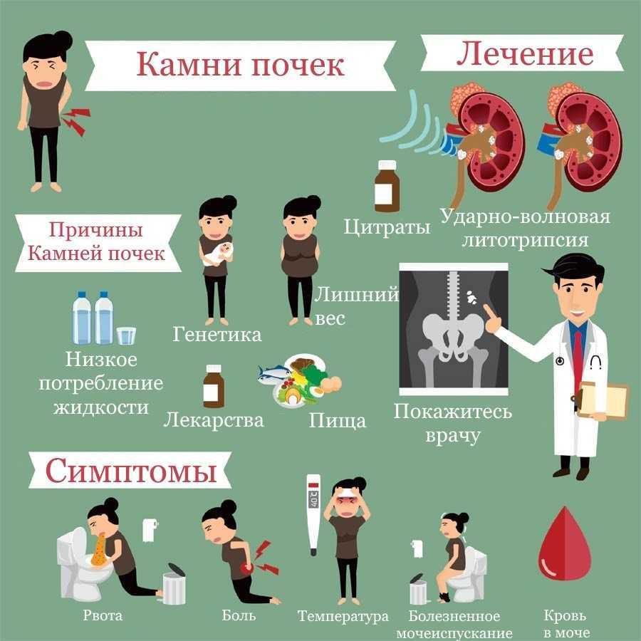 Мочекаменная болезнь: симптомы, причины и методы лечения