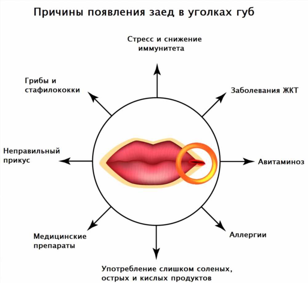 Почему появляются трещины на половых губах: причины и способы лечения